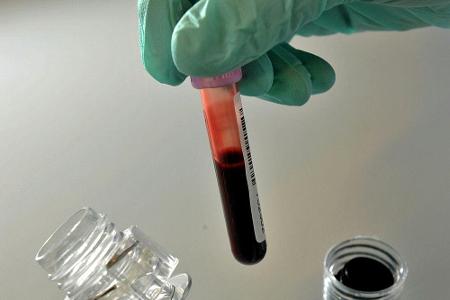 Doping bei Juniorinnen-EM: EHF ermittelt gegen russischen Verband Doping bei Juniorinnen-EM: EHF ermittelt gegen russischen Verband