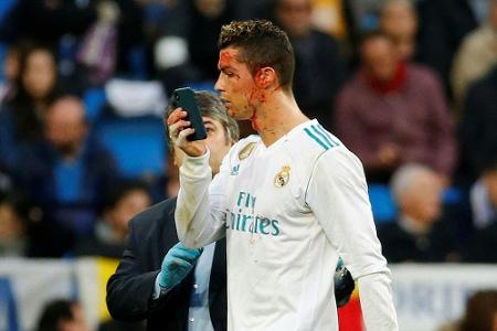 Ronaldo schaut sich Platzwunde mit Handy an - Entschuldigung von Schär Ronaldo schaut sich Platzwunde mit Handy an - Entschuldigung von Schär