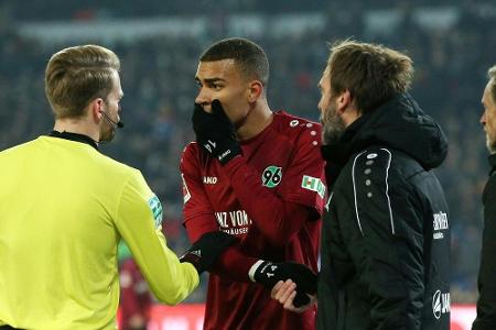 Hannovers Akpoguma kugelt sich Schulter aus Hannovers Akpoguma kugelt sich Schulter aus