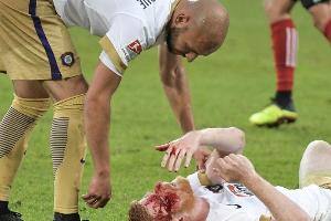 ACHTUNG FRÜHDIENST !!! IFAB diskutiert wieder über Auswechslungen bei Kopfverletzungen