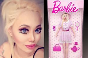 Teure Augen-OP: Ophelia will wie Barbie-Puppe sein 