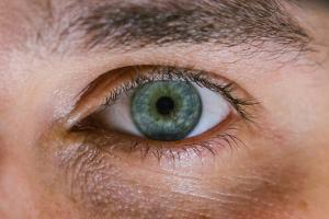 Das Office-Eye-Syndrom: Trockene Augen durch den Bildschirm