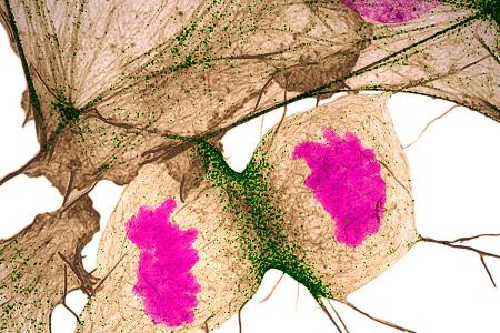 k-#11 - Fibroblast Division.jpg