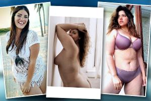 Perfekt ist langweilig: Diese tollen Frauen sind anders schön