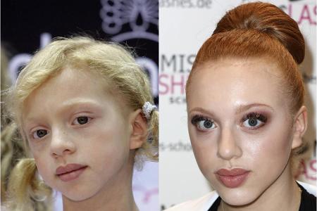Vor 18 Jahren kam Anna Ermakova auf die Welt und alles staunte über die Ähnlichkeit zu ihrem Vater Boris Becker. So hat sich... Vor 18 Jahren kam Anna Ermakova auf die Welt und alles staunte über die Ähnlichkeit zu ihrem Vater Boris Becker. So hat sich...