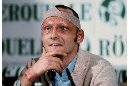 Mit schweren Verbrennungen konnte Lauda dem Tod gerade noch einmal von der Schippe springen. Bei einer Pressekonferenz in Sa...