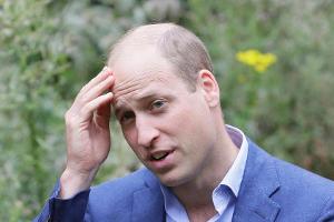 Prinz William ist der heißeste Promi-Glatzkopf