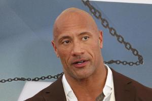 Blutiger Unfall: Dwayne Johnson zeigt seine Sportverletzung