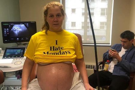 Schwangerschaftsuntersuchung bei Amy Schumer Schwangerschaftsuntersuchung bei Amy Schumer