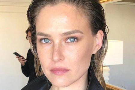 Bar Refaeli steht zu ihrem kleinen Hautproblem Bar Refaeli steht zu ihrem kleinen Hautproblem