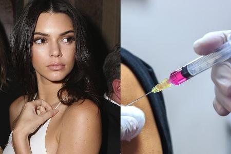 Auch Kendall Jenner soll sich einer Schönheitsbehandlung unterzogen haben Auch Kendall Jenner soll sich einer Schönheitsbehandlung unterzogen haben