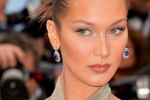 Bella Hadid: "Ich will mein Gesicht nicht verunstalten"