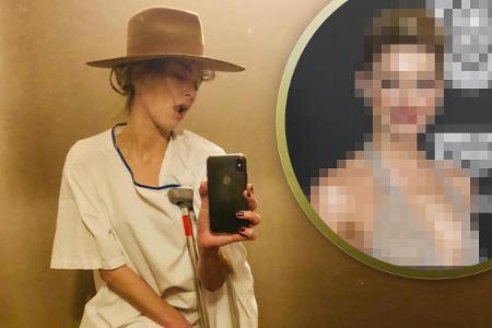 Schauspielerin Amber Heard lässt sich von einem Knochenbruch nicht die Laune vermiesen Schauspielerin Amber Heard lässt sich von einem Knochenbruch nicht die Laune vermiesen