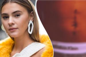 Stefanie Giesinger zeigt auf Instagram ihre OP-Narbe