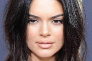 Mit Akne auf den roten Teppich: Kendall Jenner steht zu ihren Pickeln
