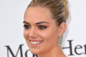 Kate Upton: So erlebte sie den gefährlichen Sturz von einem Felsen