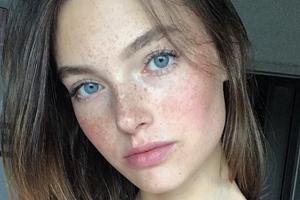 "GNTM"-Gewinnerin Céline: Das musste weg