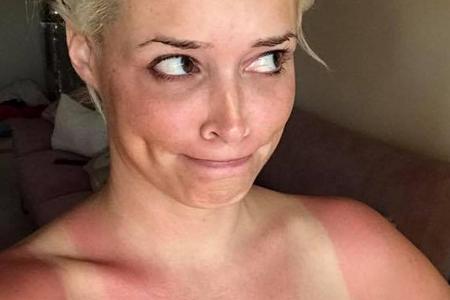 Das war wohl etwas zu viel Sonne für Daniela Katzenberger Das war wohl etwas zu viel Sonne für Daniela Katzenberger