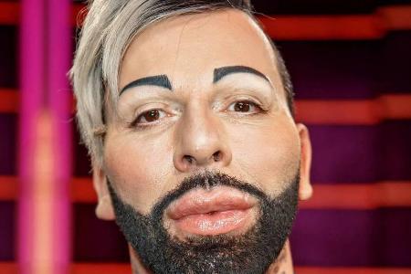 Dieses Bild von Harald Glööckler entstand noch kurz vor dem Eingriff Dieses Bild von Harald Glööckler entstand noch kurz vor dem Eingriff