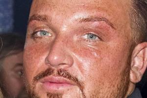 Menowin Fröhlich: Seine Verlobte hat das Baby verloren