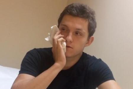 Tom Holland hat nun einen Weisheitszahn weniger Tom Holland hat nun einen Weisheitszahn weniger