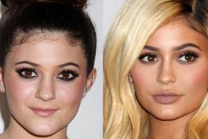 Kylie Jenner und ihre vollen Lippen: Das steckt wirklich dahinter