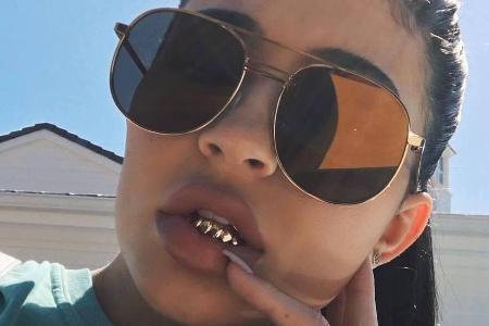 Auch Kylie Jenner trägt die Fake-Goldzähne in der unteren Zahnreihe