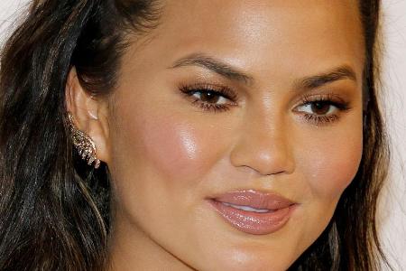 Chrissy Teigen hat ein haariges Problem Chrissy Teigen hat ein haariges Problem