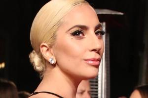 Fans entsetzt: Warum sieht Lady Gaga aus wie Kim Kardashian?