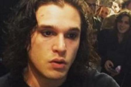 Schnipp, schnapp - Bart ab! Kit Harington schockte die Fans mit einer Radikalrasur