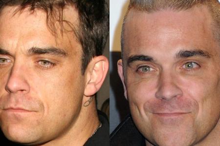 Robbie Williams 2007 (links) im Vergleich mit einer jüngeren Aufnahme Robbie Williams 2007 (links) im Vergleich mit einer jüngeren Aufnahme
