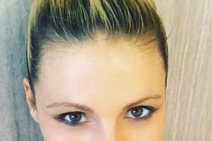 Rätsel um Michelle Hunzikers dunklen Haaransatz