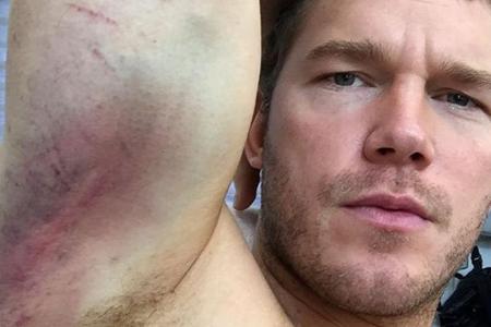 Chris Pratts Oberarme sehen echt übel aus Chris Pratts Oberarme sehen echt übel aus