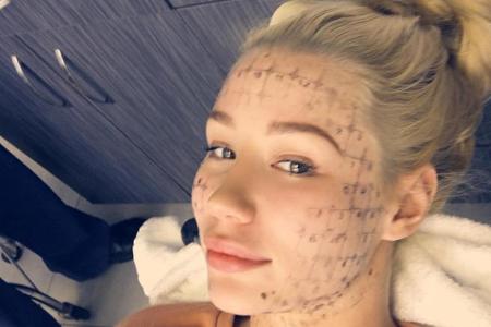 Iggy Azalea beim Schönheitsdoktor Iggy Azalea beim Schönheitsdoktor