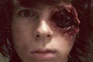 Chandler Riggs: Der Schuss ging ins Auge