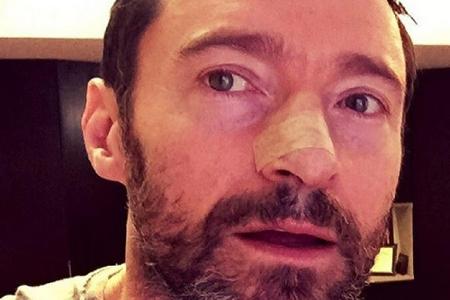 Hugh Jackman mit Pflaster: Das Resultat der jüngsten Hautkrebs-OP des Stars Hugh Jackman mit Pflaster: Das Resultat der jüngsten Hautkrebs-OP des Stars