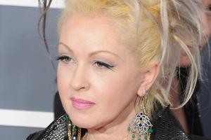 Cyndi Lauper leidet seit Jahren unter Schuppenflechte