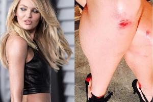 Gefallener Engel: Candice Swanepoel nimmt es gelassen