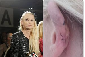 Badeunfall! Jenny Elvers verletzt sich im Urlaub