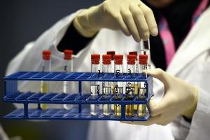 Doping: Anwaltverein fordert mehr Schwerpunktstaatsanwaltschaften