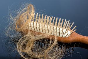 Was stimmt und was nicht: 10 Mythen über Haarausfall