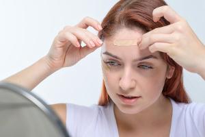 Viraler TikTok-Trend: Sind Hautpflaster eine Alternative zu Botox?