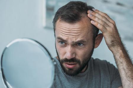 Das kostet eine Haartransplantation