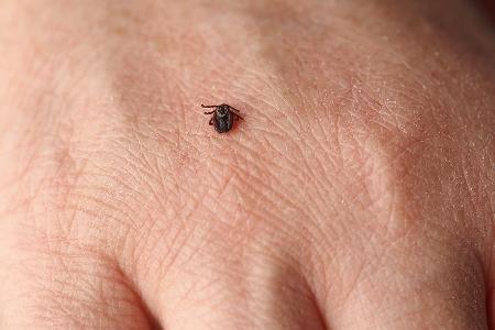 Zeckensaison hat begonnen: So schützen Sie sich vor den Parasiten