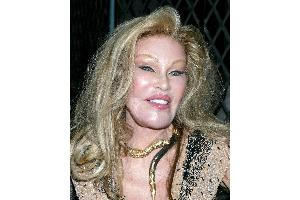 Jocelyn Wildenstein - wie sie zur Katzenfrau wurde