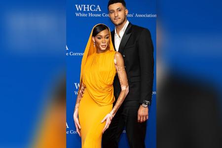 Model Winnie Harlow zeigt: So edel kann Orange aussehen Model Winnie Harlow zeigt: So edel kann Orange aussehen