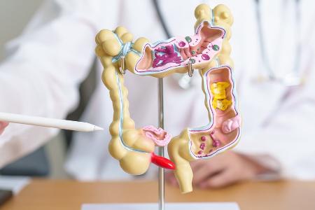 Krebsvorsorge: Diese regelmäßigen Check-ups sind wichtig Krebsvorsorge: Diese regelmäßigen Check-ups sind wichtig