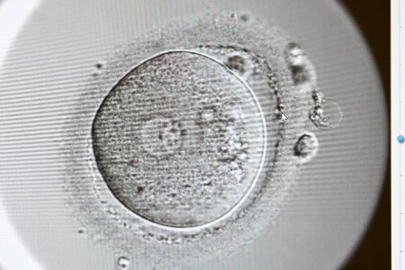 Expertinnen raten: Wer Endometriose und einen Kinderwunsch hat, sollte mit einer Kinderwunschbehandlung nicht zu lange warten, wenn es auf natürlichem Wege nicht klappt. 