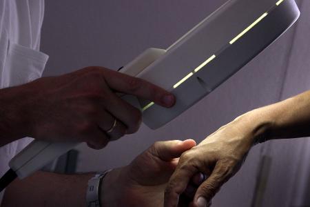 Gesetzlich Versicherte können ab einem Alter von 35 Jahren alle zwei Jahre ein Hautkrebsscreening in Anspruch nehmen.