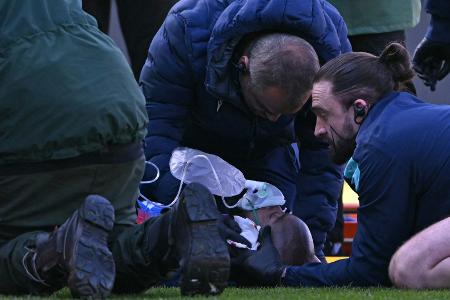 FA Cup: Mateta nach Horror-Foul im Krankenhaus FA Cup: Mateta nach Horror-Foul im Krankenhaus